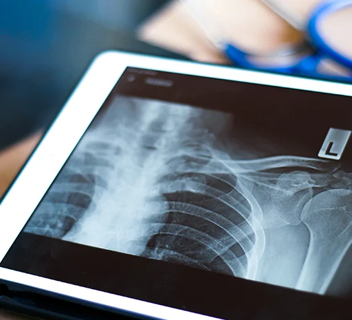 정형외과 마케팅 이미지